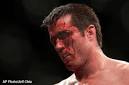 Chael Sonnen's failed drug