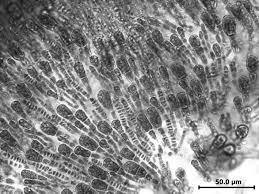 Attēlu rezultāti vaicājumam “Leskea polycarpa sporophyte”