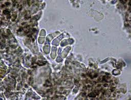 Attēlu rezultāti vaicājumam “Arthonia spadicea”