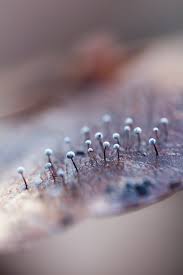 Attēlu rezultāti vaicājumam “Hemitrichia decipiens var. hemitrichoides spores”