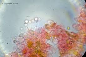 Attēlu rezultāti vaicājumam “Basidiodendron”