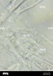 Attēlu rezultāti vaicājumam “Cudoniella acicularis”