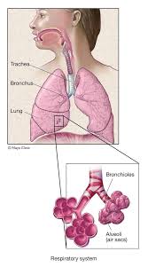 Image result for asbestosis
