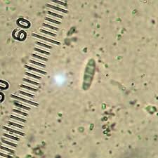 Attēlu rezultāti vaicājumam “Opegrapha atra”