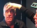 Billy Costa getting Botox!