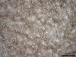 Attēlu rezultāti vaicājumam “Diachea leucopodia spores”