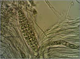 Attēlu rezultāti vaicājumam “Thelotrema lepadinum”