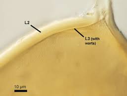 Attēlu rezultāti vaicājumam “Diderma subviridifuscum var. macrospora* spores”