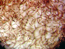 Attēlu rezultāti vaicājumam “Lycogala ustulatum sessile”