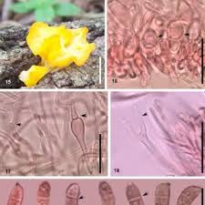 Attēlu rezultāti vaicājumam “Dacrymyces chrysospermus spores”