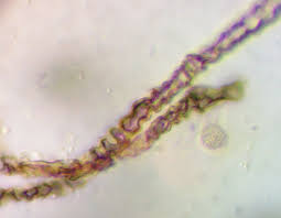 Attēlu rezultāti vaicājumam “Lycogala convexum macro”
