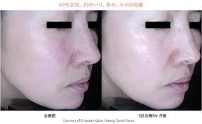 「エレア・サーブラフ」の画像検索結果