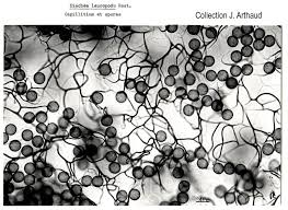 Attēlu rezultāti vaicājumam “Diachea leucopodia spores”