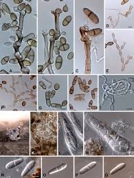 Attēlu rezultāti vaicājumam “Enteridium variabile spores”