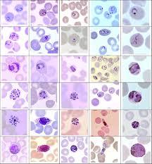 Attēlu rezultāti vaicājumam “Cribraria purpurea plasmodium”