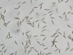 Attēlu rezultāti vaicājumam “Stemonitopsis aequalis var. microspora stalked”