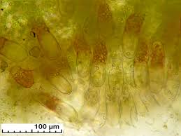 Attēlu rezultāti vaicājumam “Pellia”