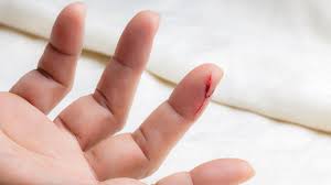 Znalezione obrazy dla zapytania palec