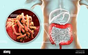 Attēlu rezultāti vaicājumam “Gulielmina vermicularis macro”