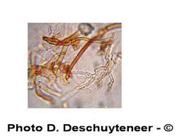 Attēlu rezultāti vaicājumam “Phellinus ferruginosus”