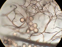 Attēlu rezultāti vaicājumam “Stemonitopsis aequalis (var. aequalis) spores”