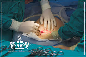 Image result for cesarskie