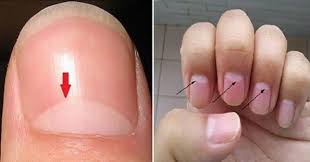 Image result for lunula nail