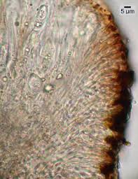 Attēlu rezultāti vaicājumam “Hertelidea botryosa”