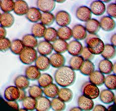 Attēlu rezultāti vaicājumam “Lycogala fuscoolearium spores”