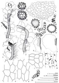 Attēlu rezultāti vaicājumam “Fossombronia wondraczekii spores”