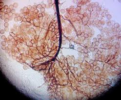 Attēlu rezultāti vaicājumam “Paradiacheopsis rigida macro”