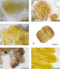 Attēlu rezultāti vaicājumam “Gloeocapsa rupestris”