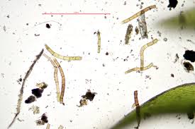 Attēlu rezultāti vaicājumam “Bryum moravicum”