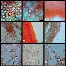 Attēlu rezultāti vaicājumam “Stemonaria irregularis young”