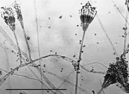 Attēlu rezultāti vaicājumam “Ceratiomyxa morchella stalked”