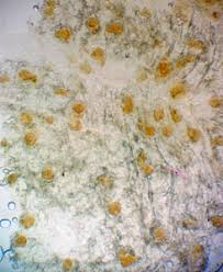 Attēlu rezultāti vaicājumam “Lycogala cf. oleocrystalliferum”