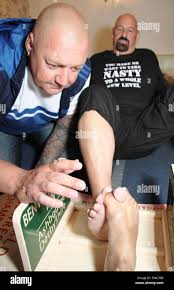 Image result for Toe Wrestling World Championships