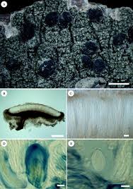 Attēlu rezultāti vaicājumam “Mycoblastus sanguinarius”