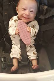 Image result for Nanismo Primordial