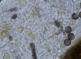 Attēlu rezultāti vaicājumam “Licea minima”