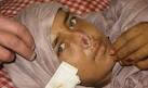 Husband Cuts Off Wife's Nose in Turkish village – Then She Gets ...