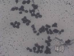 Attēlu rezultāti vaicājumam “Ruzenia spermoides”