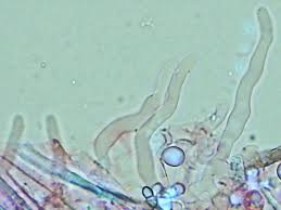 Attēlu rezultāti vaicājumam “Crustoderma dryinum”