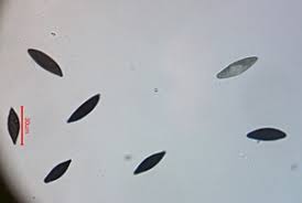 Attēlu rezultāti vaicājumam “Octospora splachnophila spores”