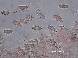 Attēlu rezultāti vaicājumam “Biatora sphaeroides”