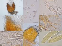 Attēlu rezultāti vaicājumam “Octosporella jungermanniarum”