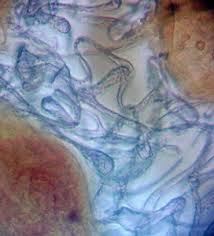 Attēlu rezultāti vaicājumam “Lycogala cf. convexum”