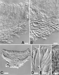 Attēlu rezultāti vaicājumam “Hyphodiscus hymeniophilus”