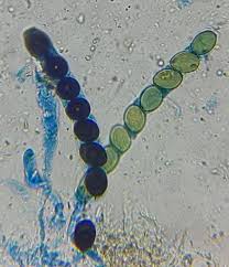 Attēlu rezultāti vaicājumam “Sordaria fimicola”