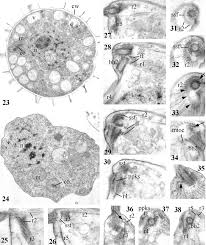 Attēlu rezultāti vaicājumam “Lycogala epidendrum aggr.”